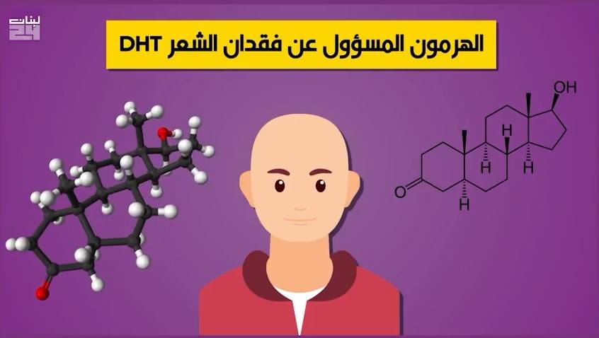 سؤال هام.. هل يسبب ارتداء القبعات بانتظام الصلع؟