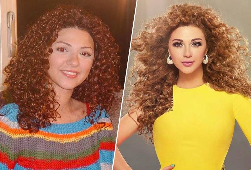 عمليات تجميل النجمات العرب...هذا هو الفرق في جمالهن!