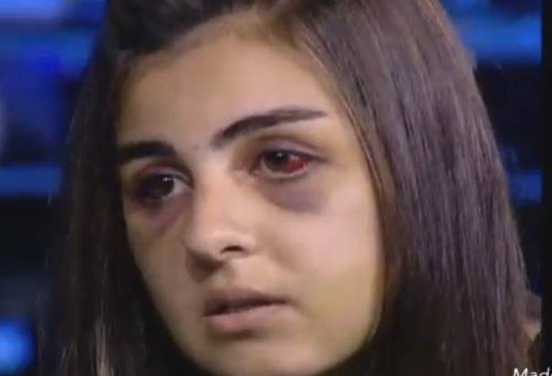 بالفيديو:سكب على زوجته اللبنانية"سبيرتو" لحرقها.. اليكم القصة الكاملة "لتمارا"