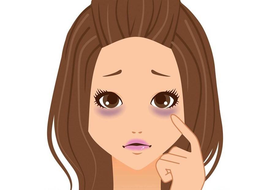 5 أمراض تكشفها الهالات السوداء تحت عينيك!