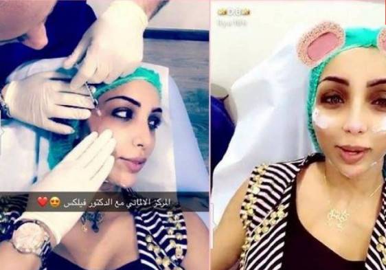 بالفيديو -  اعتراف جريء من دنيا بطمة... هذا ما غيّرته في شكلها!