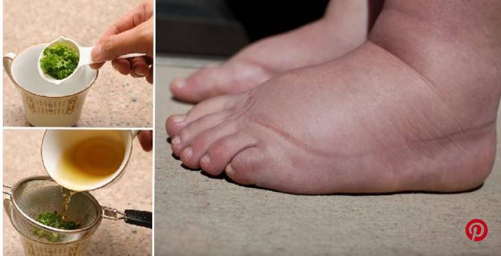 7 أشياء نقوم بها تتسبب باحتباس الماء في الجسم.. هكذا تتخلّصون منها
