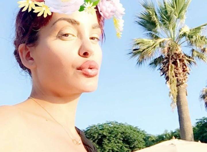 صور تفضح بوتوكس النجمات في وجوههن!