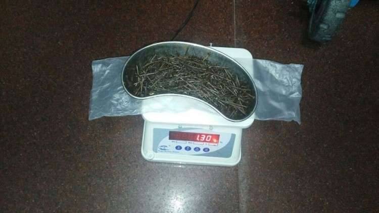 لن تصدق....استخراج 639 مسمارا من أمعاء مريض!