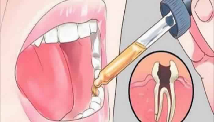 فى هذا الشتاء تخلصوا من ألم الأسنان دون الذهاب الى طبيب !