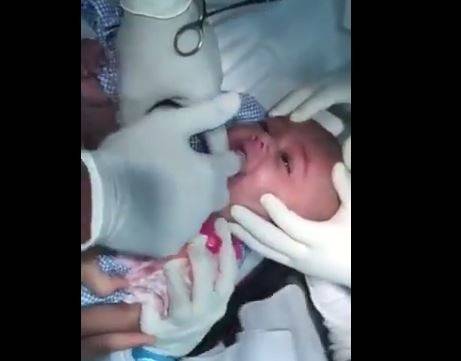 فيديو مروّع.. هذا ما سحبه طبيب من فم طفل!