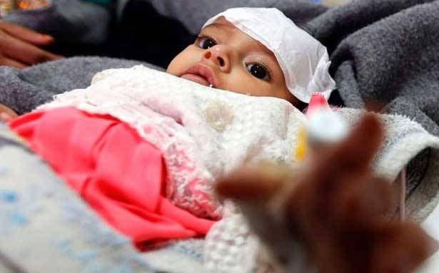 مليون طفل يمني مصابون بالكوليرا