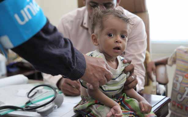 الأمم المتحدة : أكثر من 100 قتيل مدني في اليمن خلال 10 أيام