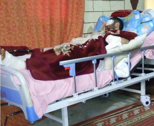 خاص الديار - مأساة "علي" المعيل الوحيد لعائلته في دورس.. بُترت يداه وفقد بصره وأكثر