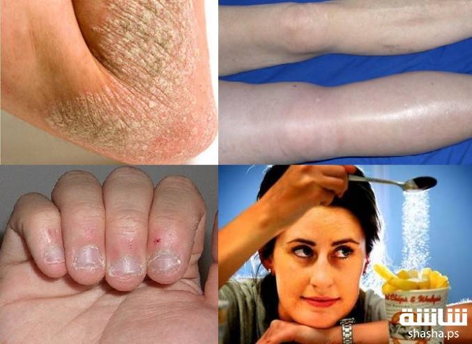4 علامات لو ظهرت على جسمك تكون مؤشراً لأعراض صحية خطيرة!