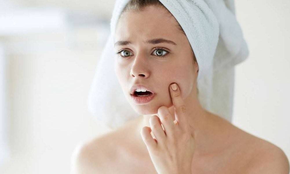 اليك أسهل طريقة للتخلّص من الرؤوس السوداء!