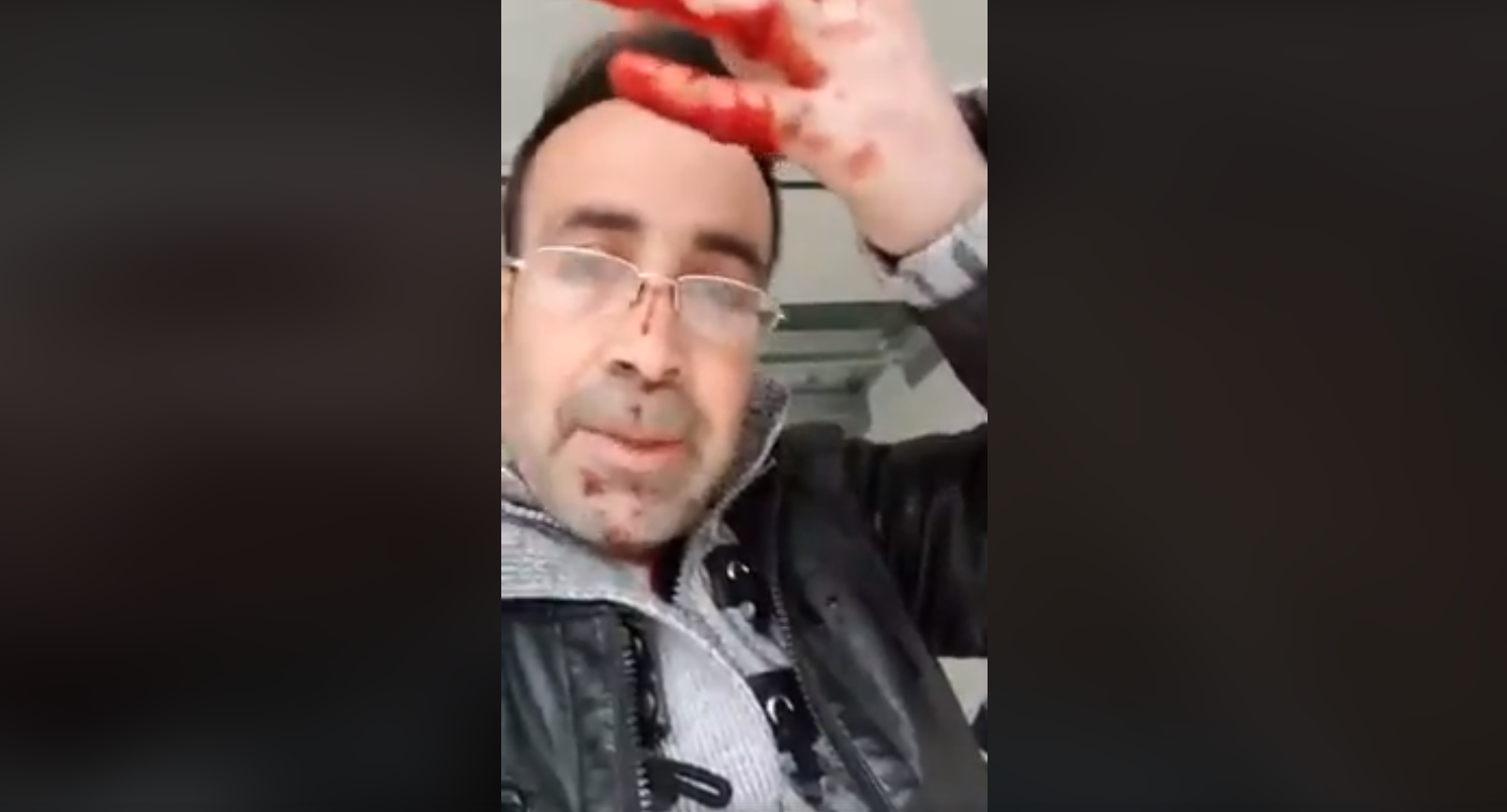 بالفيديو - لاجئ سوري يقتل زوجته على الهواء مباشرة... ويصف ما فعله بـ"نهاية رجل شجاع" !