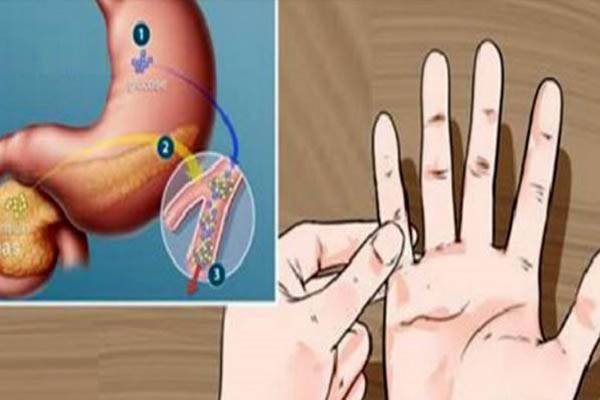 هل أنت معرض للإصابة بالسكري؟ اكتشف هذا في دقيقة واحدة!