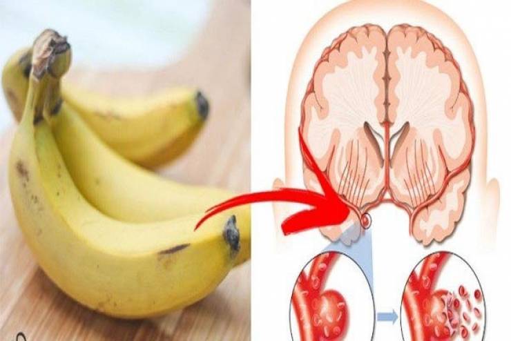 هذا ما يحدث لقلبكم، لدماغكم ولوزنكم، إذا أكلتم 3 موزات في اليوم!