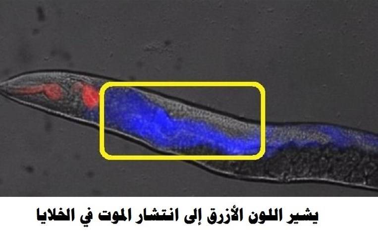 بالفيديو.. هكذا ينتشر الموت في جسم الأنسان!