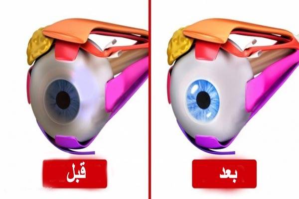 10 تمارين سهلة تقوي النظر وتجعله يتحسن بسرعة