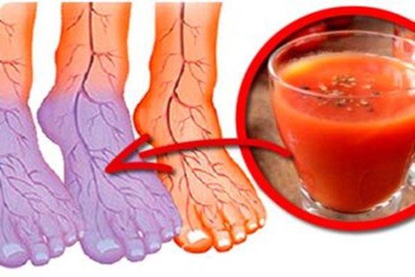 هل تعانون من دورة دمويّة سيّئة وأيدي وأقدام باردة دائماً؟ الحل عندنا!