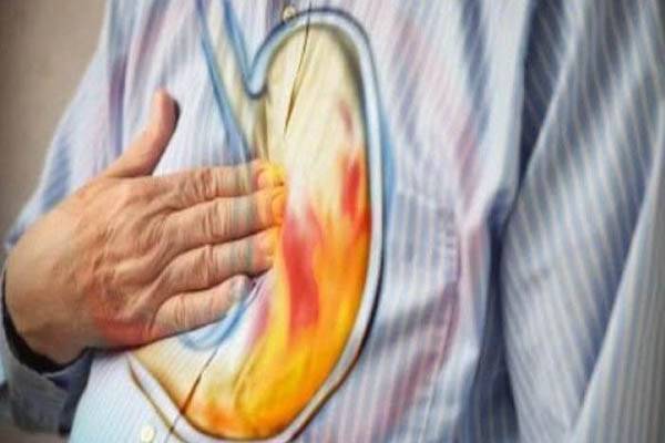 كيف توقفون حرقة المعدة في بضع ثوانٍ بدون دواء