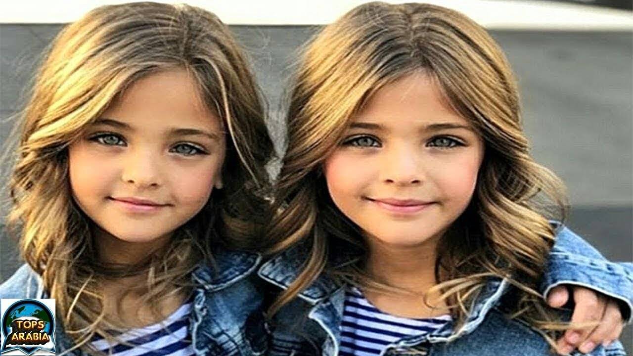 بالفيديو- ظنوا انهن سيكن توأمتان عاديتان ولكن عندما كبرن كانت الصدمة..!!