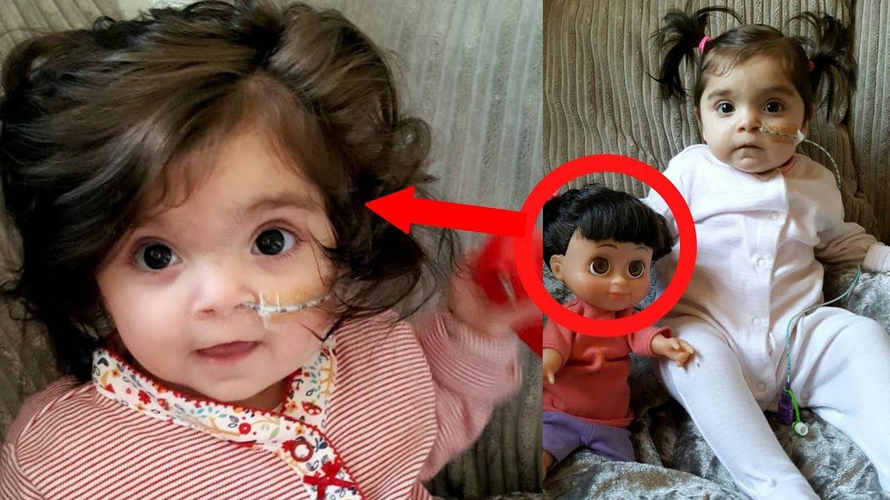 بالفيديو- عند ولادة هذه الطفلة اعتبرها الجميع دمية بسبب شيء مدهش فعلا... شاهد ما هو!