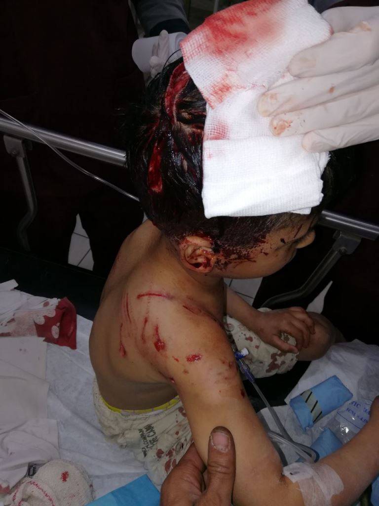 بالصورة..اصابة 3 مواطنين هاجمهم كلب مسعور في الدوير