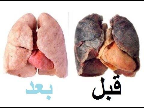 تنظيف الرئة من النيكوتين خلال 72 ساعة بطريقة جديدة وبسيطة لن تتوقعها!
