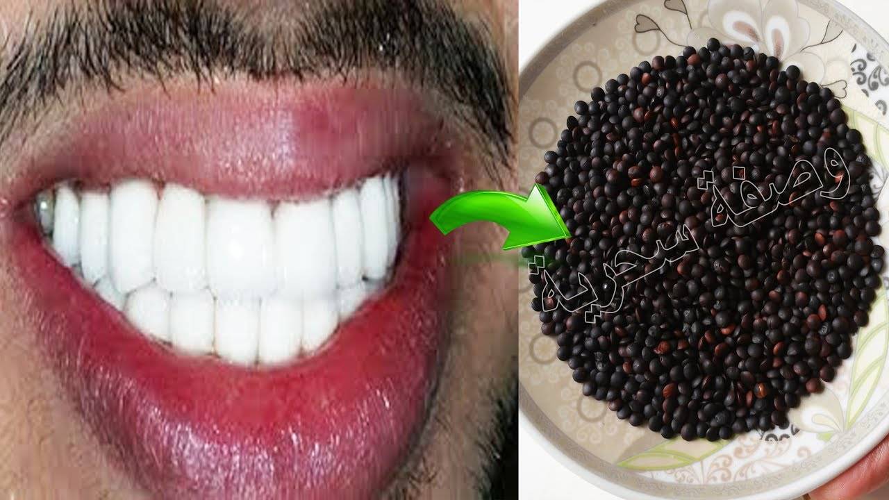 بالفيديو- ضع هده الحبات في فمك دقيقتين فقط ولن تصدق ستبيض أسنانك وتزيل الإصفرار و...!!