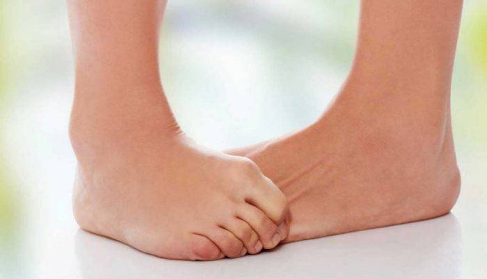 3 نقاط في القدم.. إليكم أسباب الآلام والعلاج الطبيعي