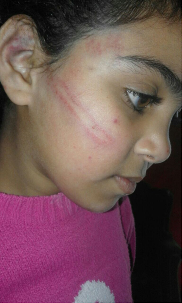 توقيف والد عنف طفلته في مخيم الرشيدية