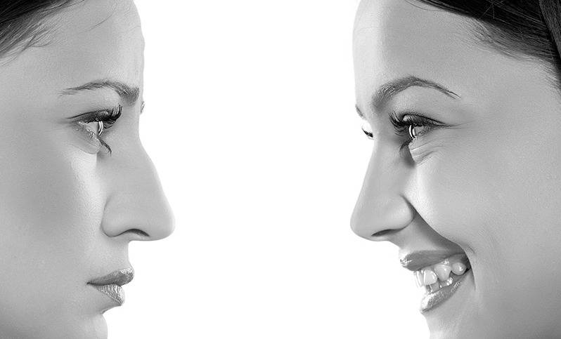 بالفيديو: قبل خضوعها لعملية التجميل الـ8.. نجمة عربية تثير الجدل بالمايو!