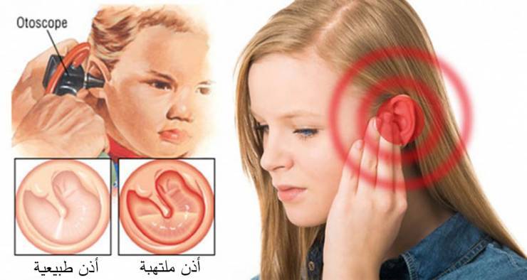 9 أعراض لتشخيص إصابتكم وإصابة أولادكم بالتهاب الأذن!