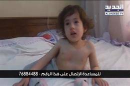 حياة الطفلة رغد في خطر