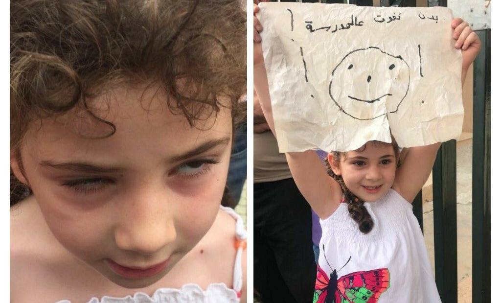 بالصور: حراس مدرسة بالنبطية يضربون طفلة.. والقضاء يتحرّك