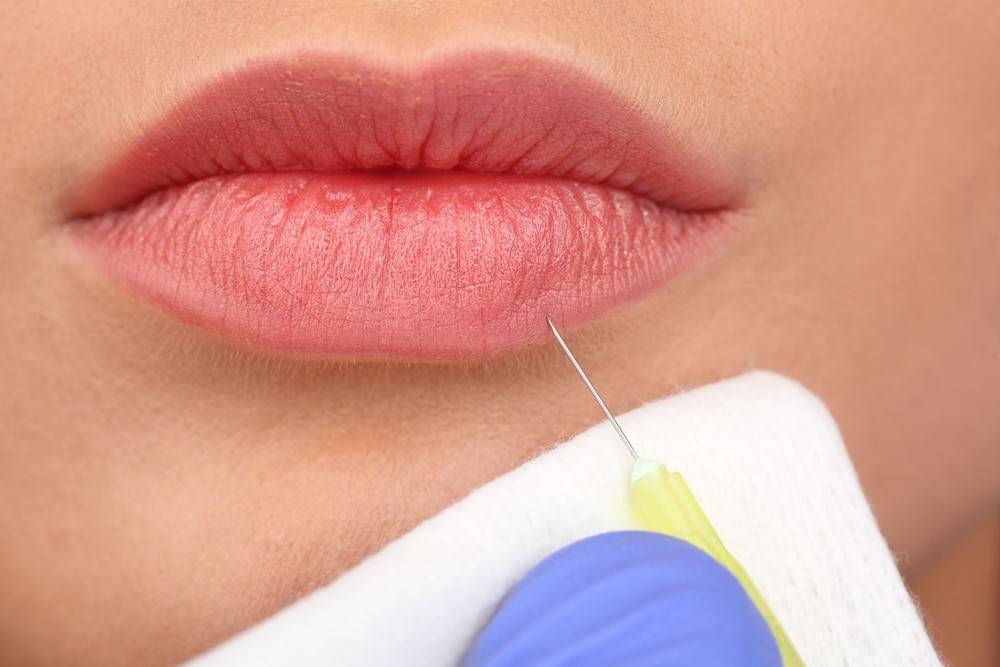 فمٌ عاجزٌ عن النطق بسبب العملية التجميلية!