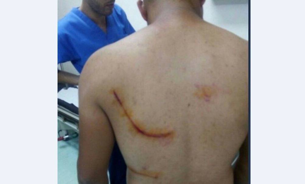 بالصورة: إشكال وتضارب في بر إلياس.. و"مالك" أصيب بسكِّين!