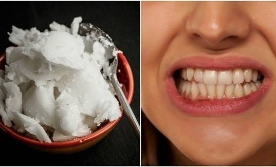 طرق طبيعية لتبييض الأسنان.. جرّبوها