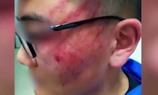 بالفيديو: 12 صفعة من الاستاذ.. أصابت التلميذ بارتجاج دماغي!