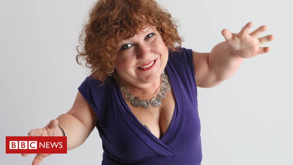 Tanyalee Davis: More train trouble for disabled comedian