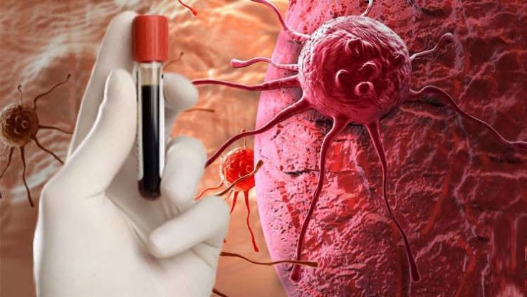 ابتكار مستحضر آمن وفعال لعلاج السرطان