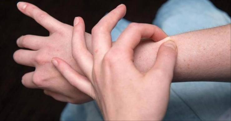 معضلة 'جلد الدجاج'.. أسبابها وكيفية علاجها