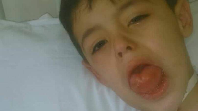 ملف الطفل محمد العوطة يهزّ الرأي العام.. فهل تأمّنت كلفة عمليّته؟