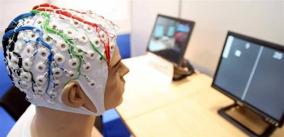 اكتشاف خلية "فريدة" في الدماغ تميّز الإنسان عن باقي الكائنات