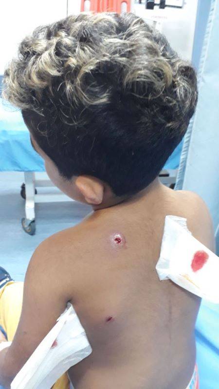 نجا من الموت بأعجوبة..رصاصة طائشة اخترقت جسد طفل