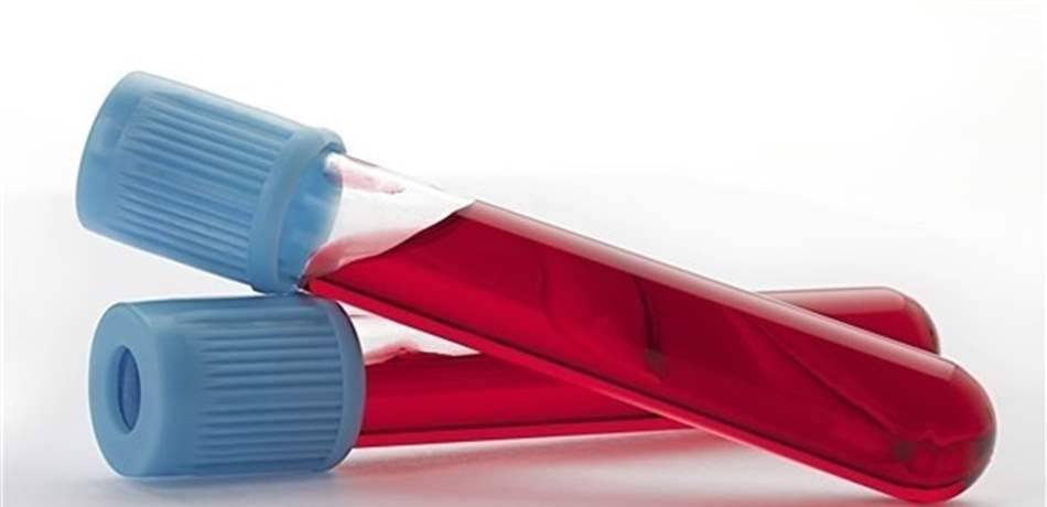 ما هي الفحوصات اللازمة بعد بلوغ سن الـ 40؟