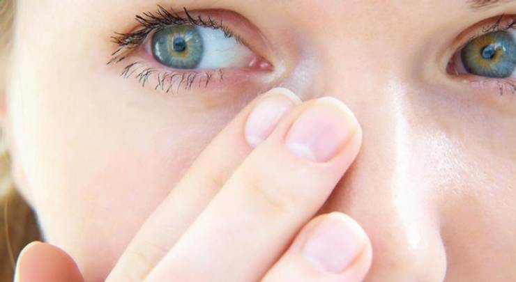 احذر الرَّمَد والتهاب العين المُعدي!