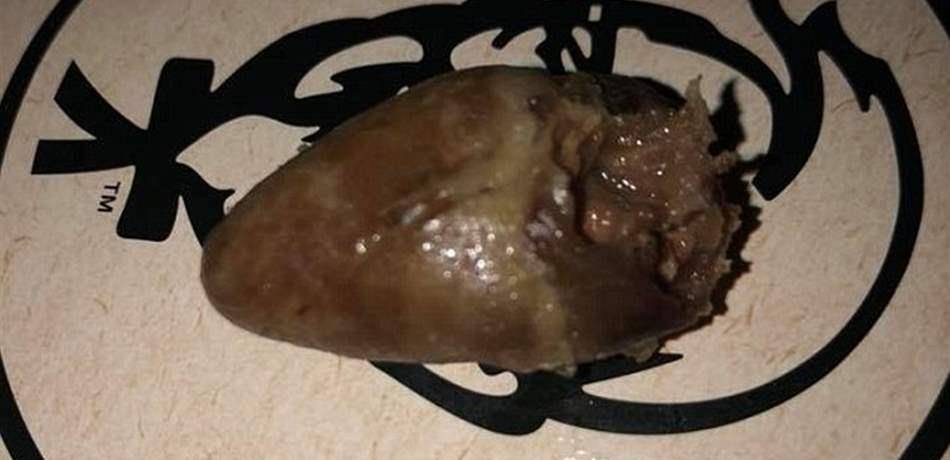 صدمة.. هذا ما عثر عليه هذا الزبون في وجبة "KFC" (بالصور)