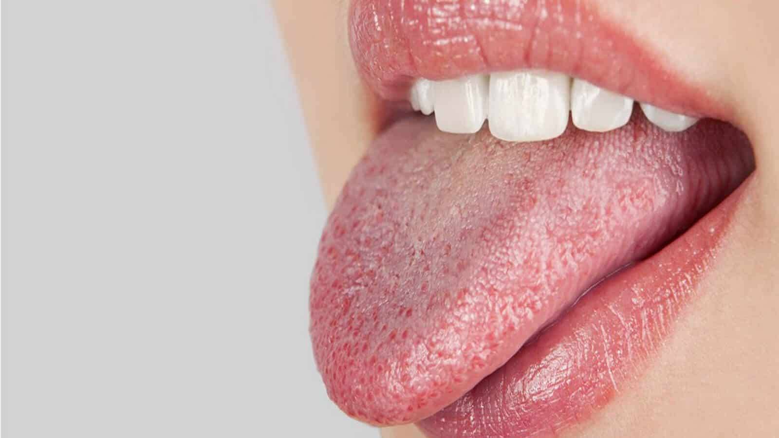 ما هي طرق الوقاية لجفاف الريق؟
