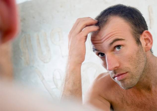 وأخيراً...علاج "غير مسبوق" للصلع