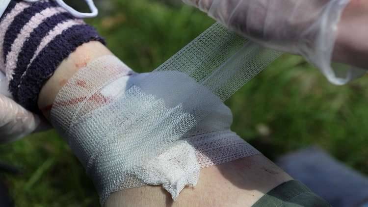 ابتكار رغوة خاصة للتخلّص من جروح النار!