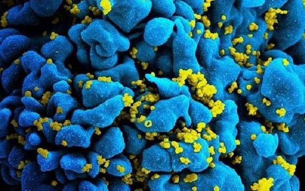 دواء لعلاج «الإيدز» ينجح في أول اختباراتـه السريريّة